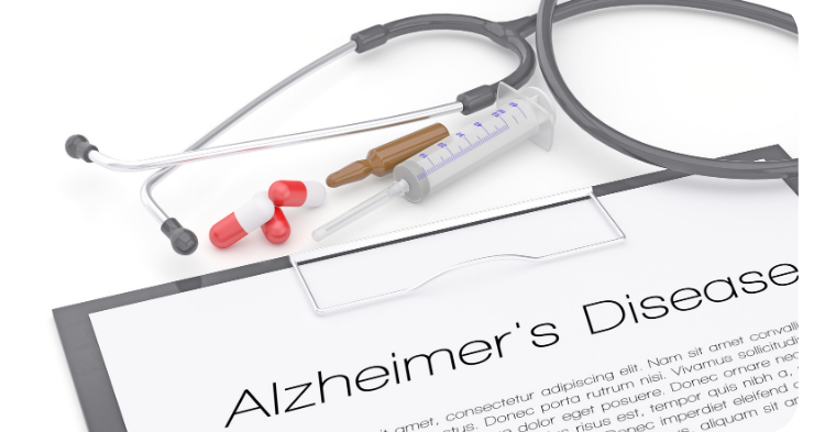 Lowering Alzheimer’s Risk